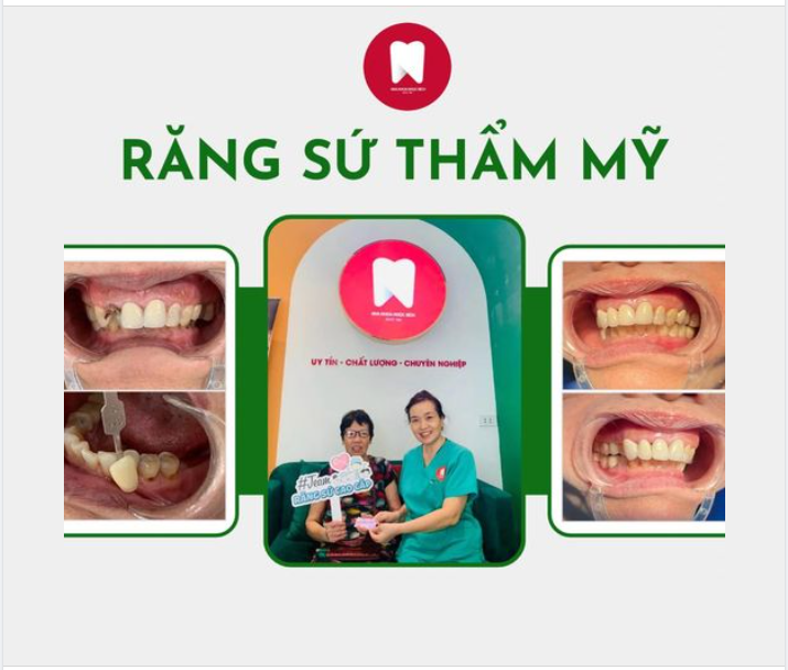 GIA NHẬP TEAM RĂNG SỨ THẨM MỸ CAO CẤP NHÀ NHA KHOA NGỌC BÍCH - KHÁCH HÀNG NHẬN ĐƯỢC GÌ