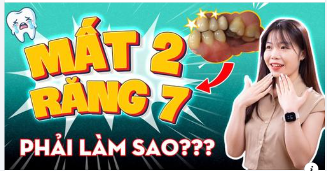 NIỀNG RĂNG - BÍ KÍP CHO "NỤ CƯỜI HOÀN HẢO" SAU KHI MẤT 2 RĂNG SỐ 7