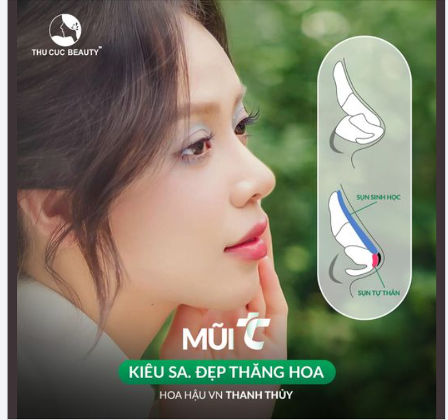 Mũi kiêu sa đẹp thăng hoa chuẩn tỷ lệ