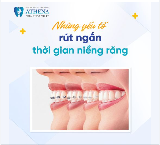 6 yếu tố giúp rút ngắn thời gian niềng răng hiệu quả