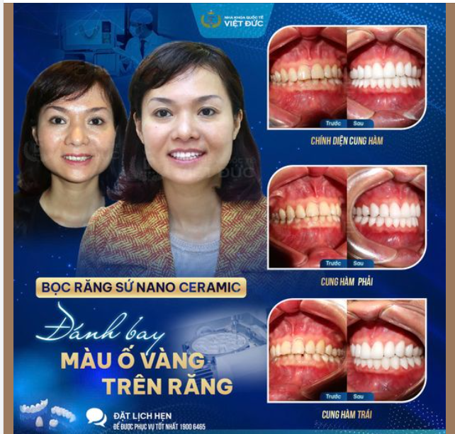 NỤ CƯỜI ĐẸP MANG LẠI NHIỀU MAY MẮN, THUẬN LỢI