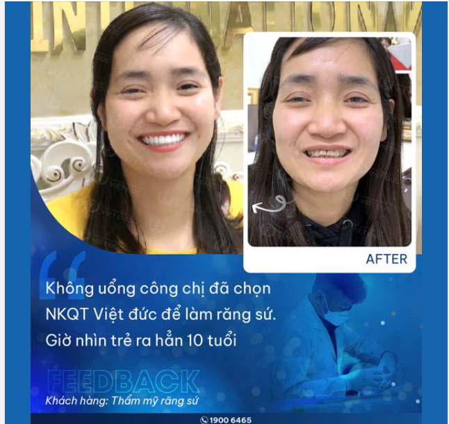 MUỐN LÀM RĂNG SỨ ĐẸP, QUAN TRỌNG LÀ LỰA CHỌN ĐƯỢC NHA KHOA UY TÍN
