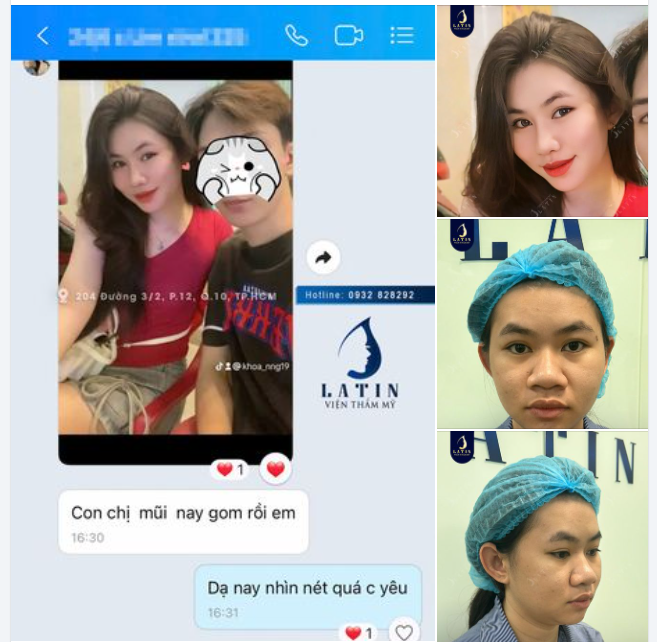 Feedback mũi cấu trúc 7 tháng tuổi