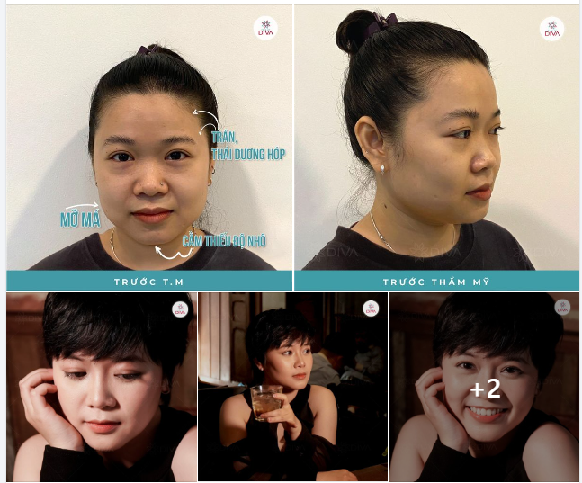 BẤT NGỜ TRƯỚC THẦN THÁI ĐẸP TỰ NHIÊN CỦA CÔ GÁI SAU THẨM MỸ