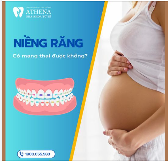 Niềng răng có mang thai được không?