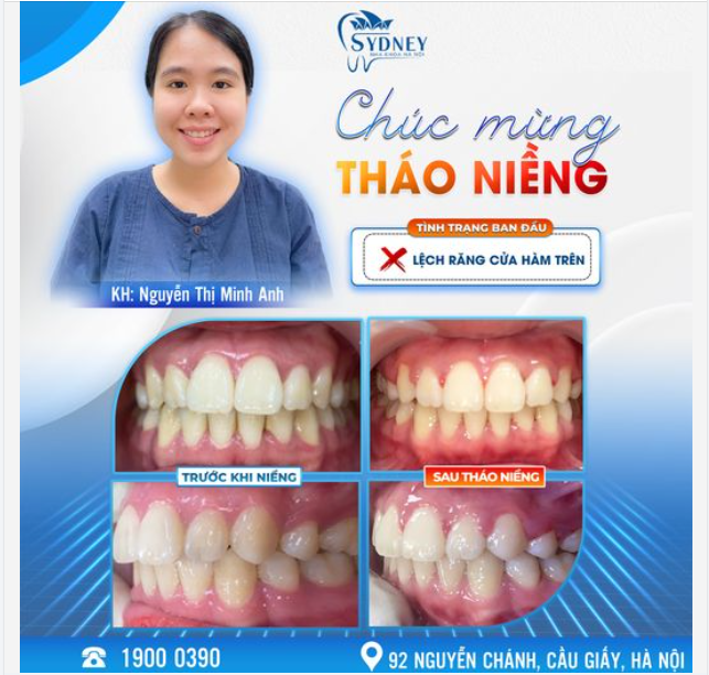 CHÚC MỪNG THÁO NIỀNG KH. MINH ANH
