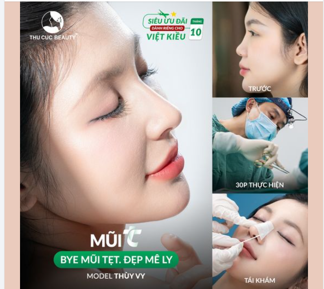 Việt Kiều sở hữu sống mũi thấp, đầu mũi to đến TC ngay
