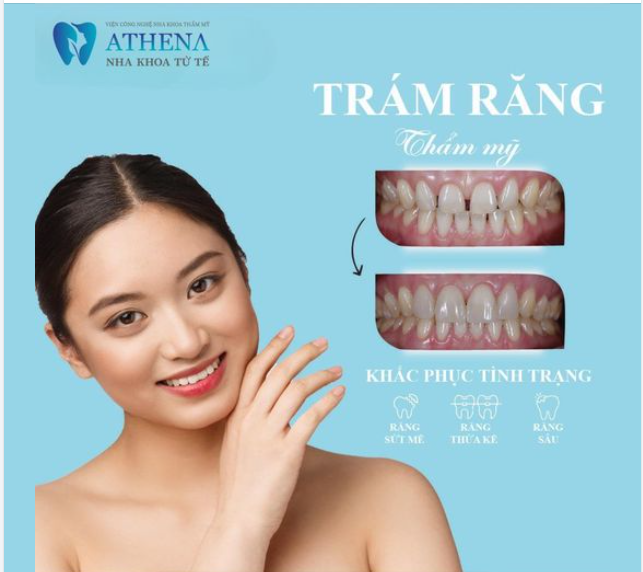 Trám răng thẩm mỹ Khắc phục hoàn hảo các tình trạng: Răng thưa kẽ Răng sứt, mẻ Răng sâu