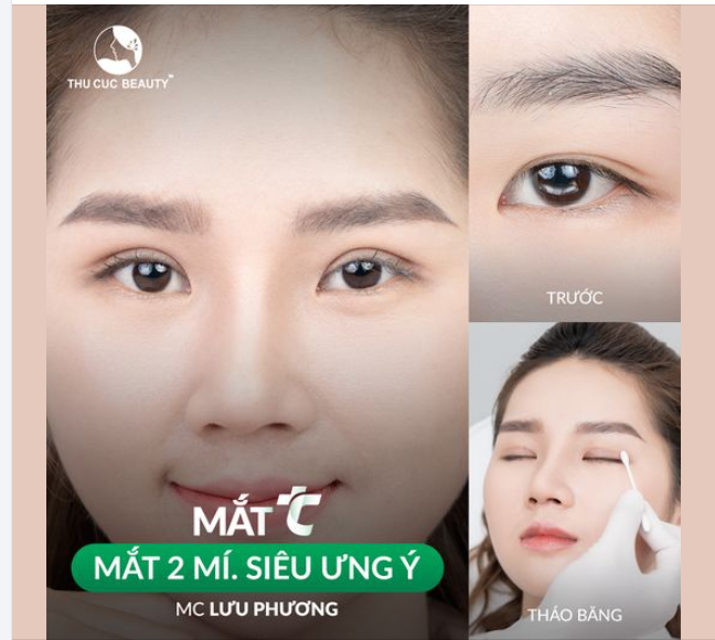  MC Lưu Phương tự tin tỏa sáng cùng nếp mí mới khi chọn Mắt TC