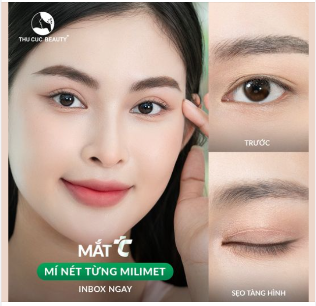 Say "bye" mí sụp, da chùng Model Hồng Ngân chọn Mắt TC