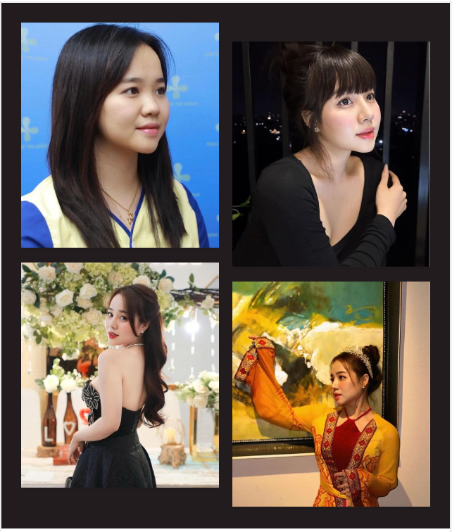 " Trộm vía tỉ lần từ khi làm mũi xong ai cũng khen, quá nhiều người hỏi Ánh làm mũi ở đâu.