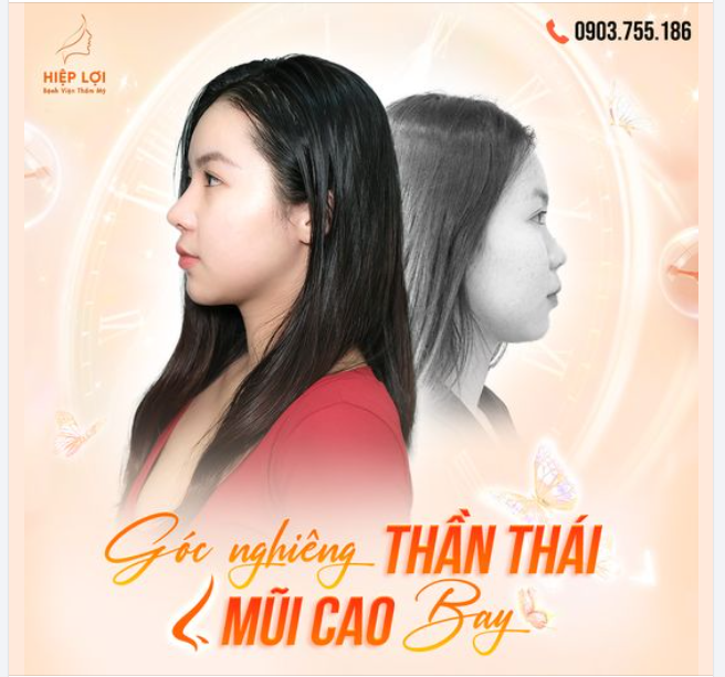 GÓC NGHIÊNG THẦN THÁI, MŨI CAO BAY – NÉT ĐẸP CHUẨN TỪNG GÓC CẠNH!