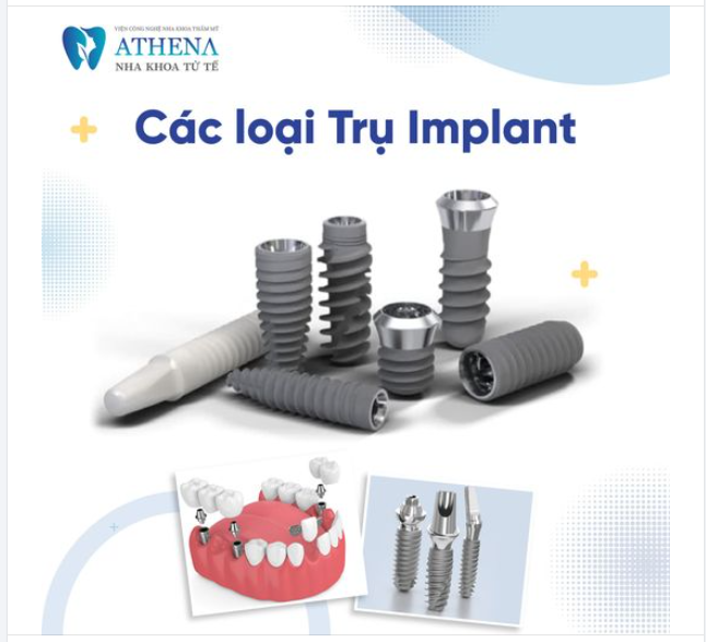Hãy cùng Nha Khoa ATHENA khám phá các loại trụ implant phổ biến nhất nhé!
