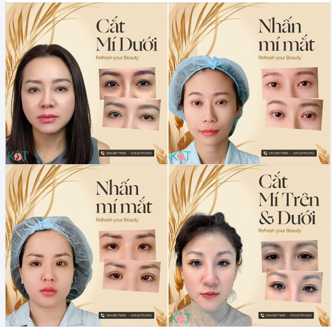 NÂNG CẤP DUNG NHAN THĂNG HẠNG CUỘC SỐNG