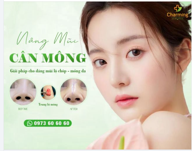NÂNG MŨI CÂN MÔNG - GIẢI PHÁP CHO NHỮNG CA MŨI KHÓ