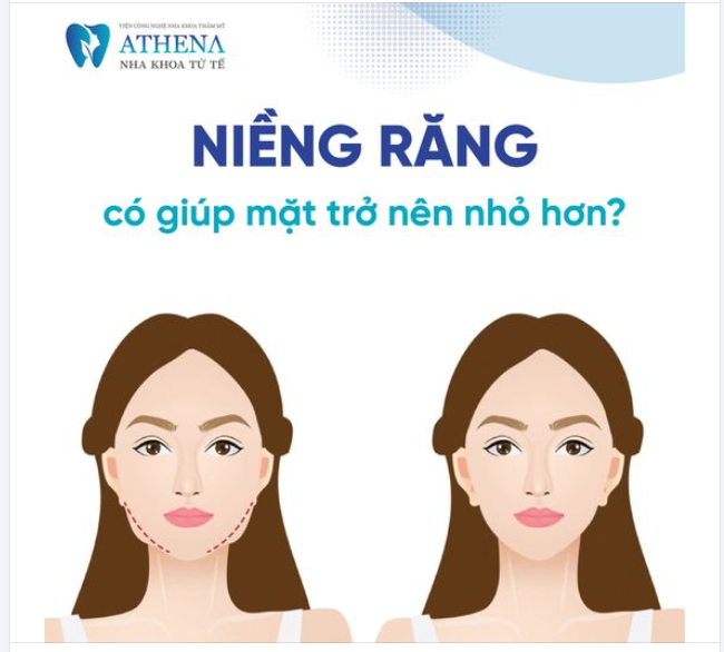 Niềng răng có giúp gương mặt nhỏ hơn không?