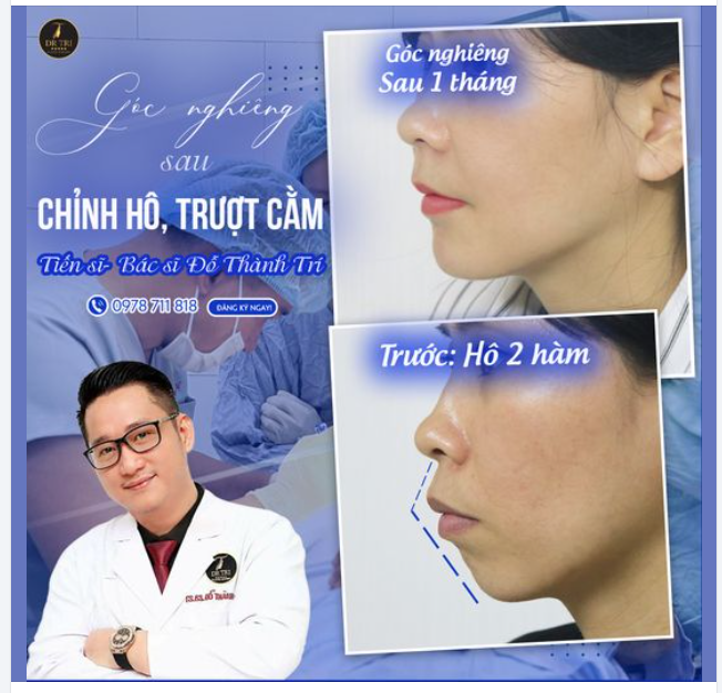 1 THÁNG VỪA HẾT HÔ VỪA ĐẸP HƠN! ​​​​​​​ LIỆU CÓ XỨNG ĐÁNG?