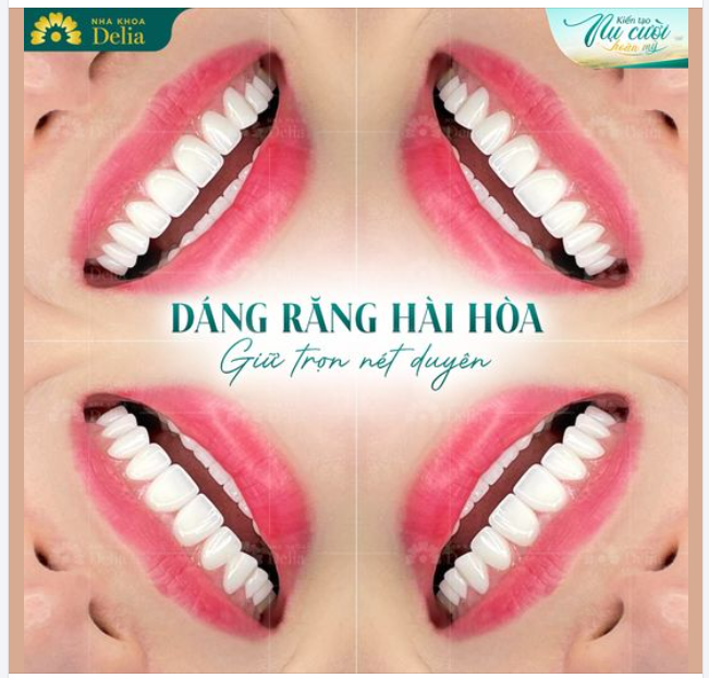 DÁNG RĂNG HÀI HÒA, GIỮ TRỌN NÉT DUYÊN