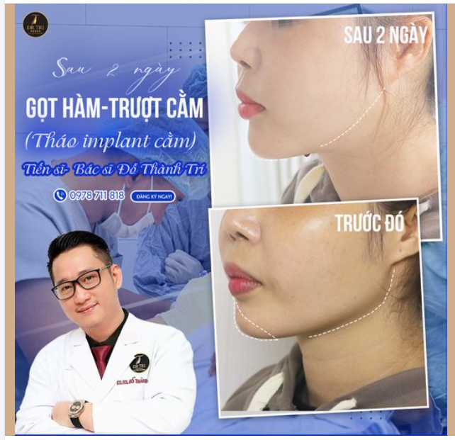 TRÔNG CHỜ KHÁCH ĐẸP HƠN TỪNG NGÀY