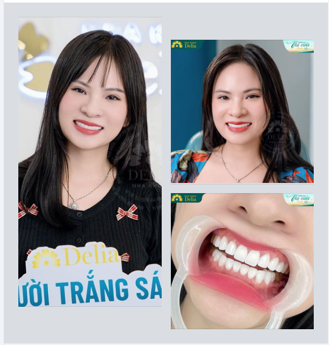 Nụ cười rạng rỡ trong tiết trời thu