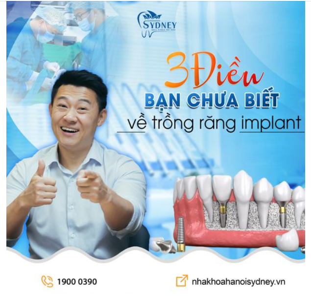 3 ĐIỀU BẠN CHƯA BIẾT VỀ TRỒNG RĂNG IMPLANT