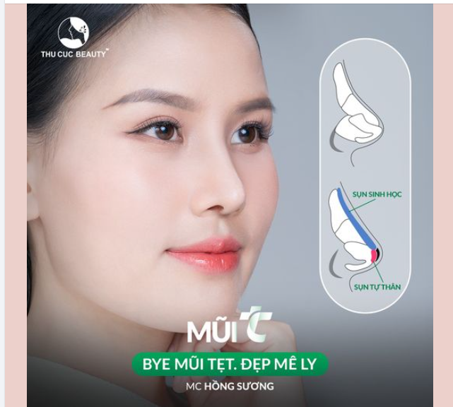 Nâng mũi cao đẹp, đảm bảo vô khuẩn