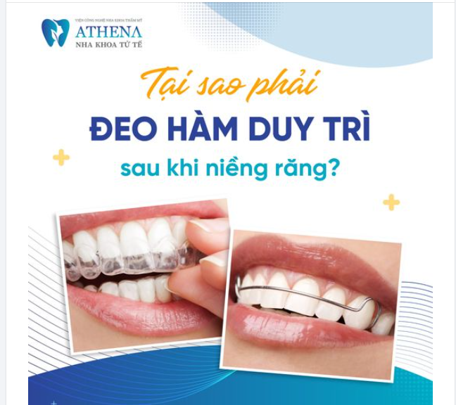 Đeo hàm duy trì bí quyết duy trì nụ cười hoàn hảo