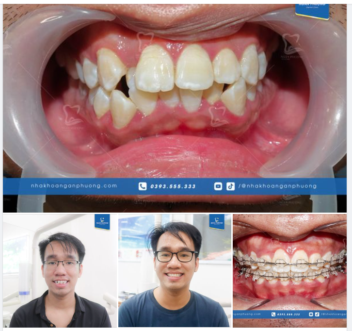 Hành trình vạn dặm đều bắt đầu từ một bước chân