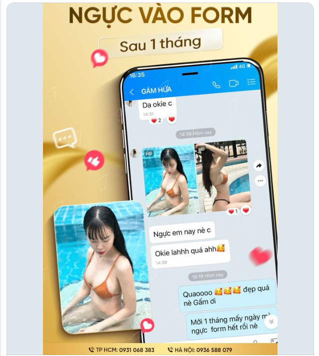 1 ngày sau nâng ngực thấy đau.  1 tuần sau nâng ngực thấy vẫn chưa đẹp  1 tháng sau nâng ngực thì hạnh phúc quá chừng.