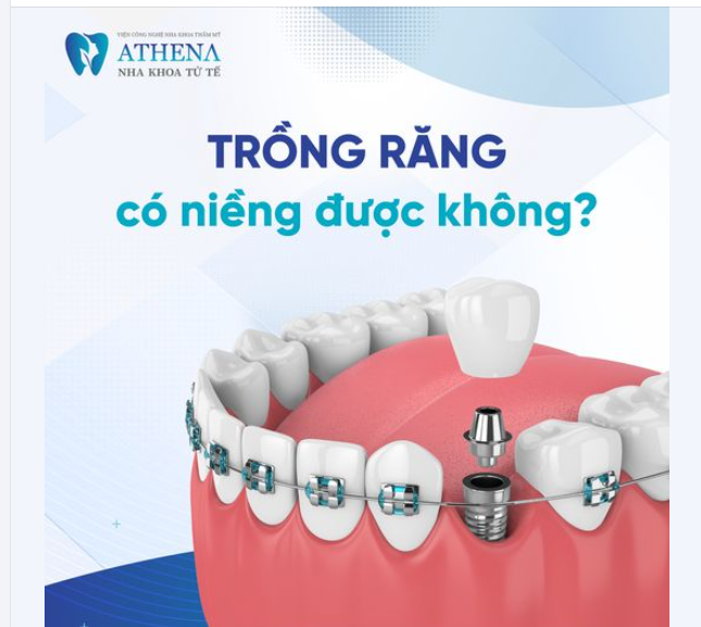 Trồng răng implant có niềng răng được không?