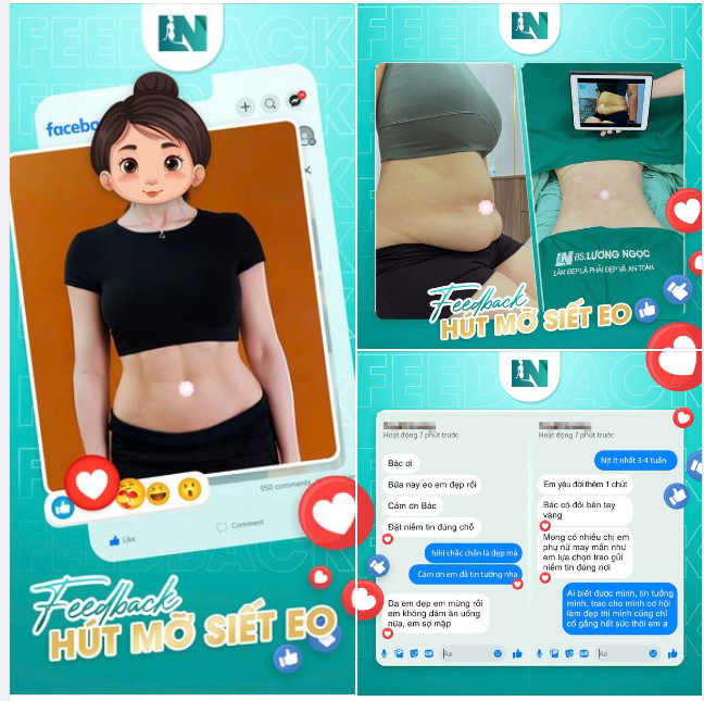FLEX NHẸ CHIẾC FEEDBACK HÚT MỠ SIẾT EO