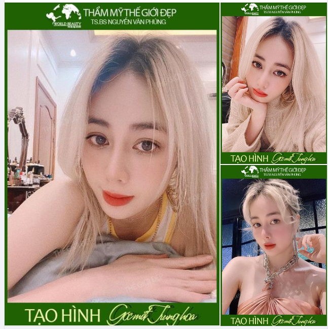 Sở hữu mắt biếc to tròn, long lanh với tạo hình góc mắt Trung Hoa
