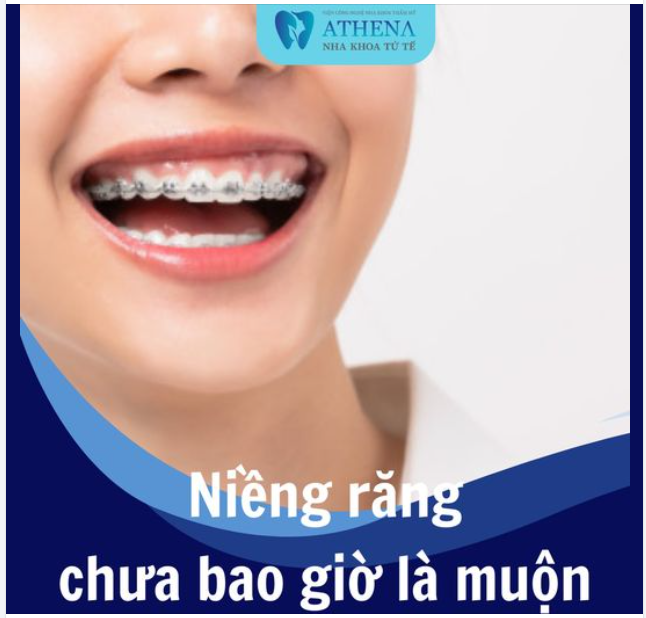 Niềng răng chưa bao giờ là muộn