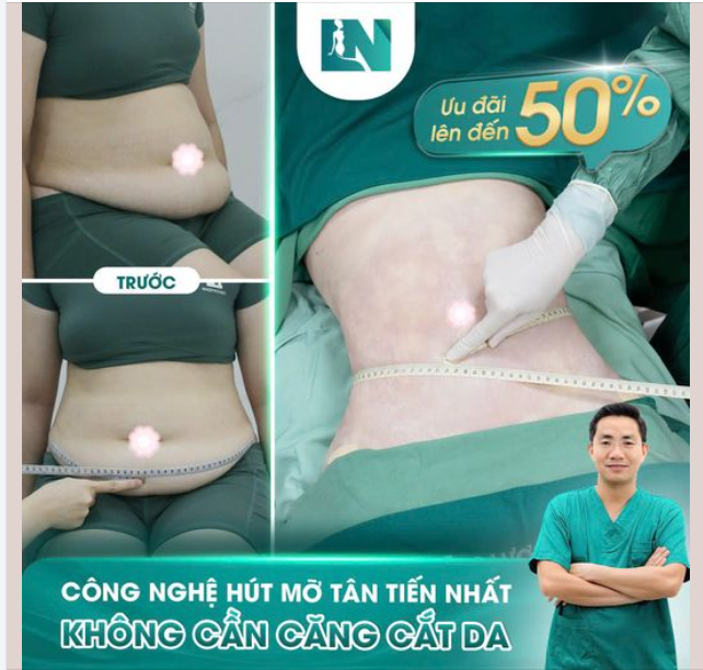 EO THON DÁNG GỌN VỚI CÔNG NGHỆ HÚT MỠ KHÔNG CẦN CĂNG CẮT DA!