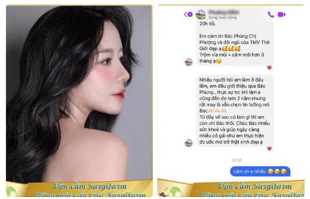 Sau phẫu thuật bằng bộ đôi Nâng mũi cấu trúc kết hợp Độn cằm, Thế Giới Đẹp giúp quý Cô hoàn thiện dung mạo vô cùng ưng ý.