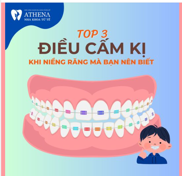 Các "đồng niềng" lưu ý 3 điểm cực kỳ quan trọng này để quá trình niềng răng của bạn diễn ra nhanh chóng hơn nhé!