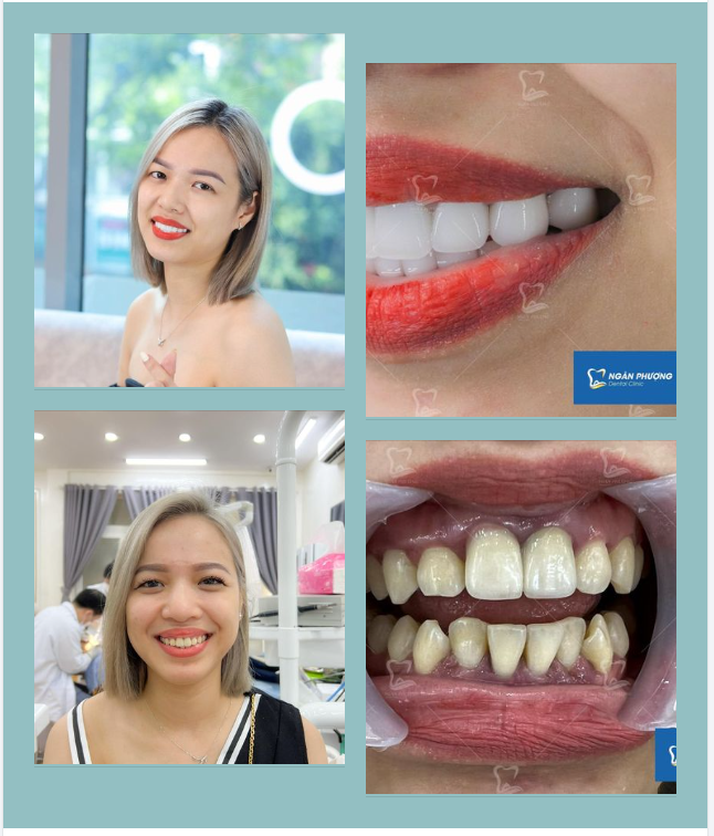 Vượt 3000km làm răng cùng bác sĩ Ngân Phượng