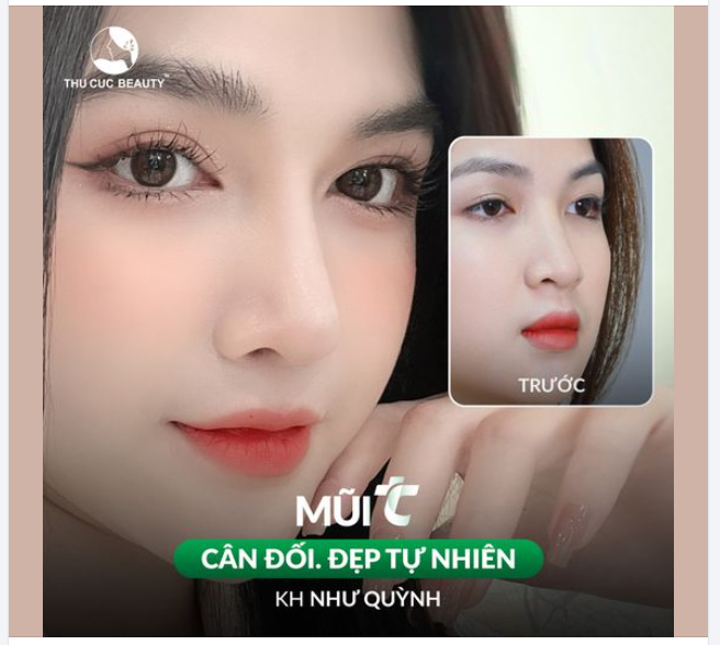 Giải cứu chiếc mũi thấp tẹt . Định hình dáng mũi hòa hợp gương mặt