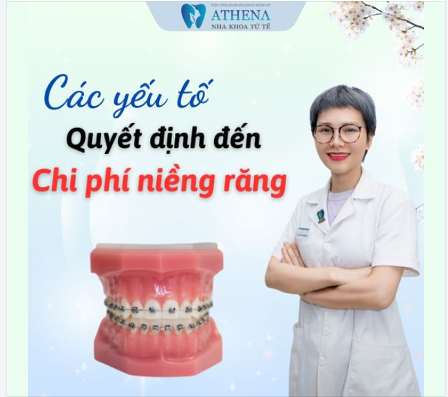 Các yếu tố quyết định đến chi phí niềng răng