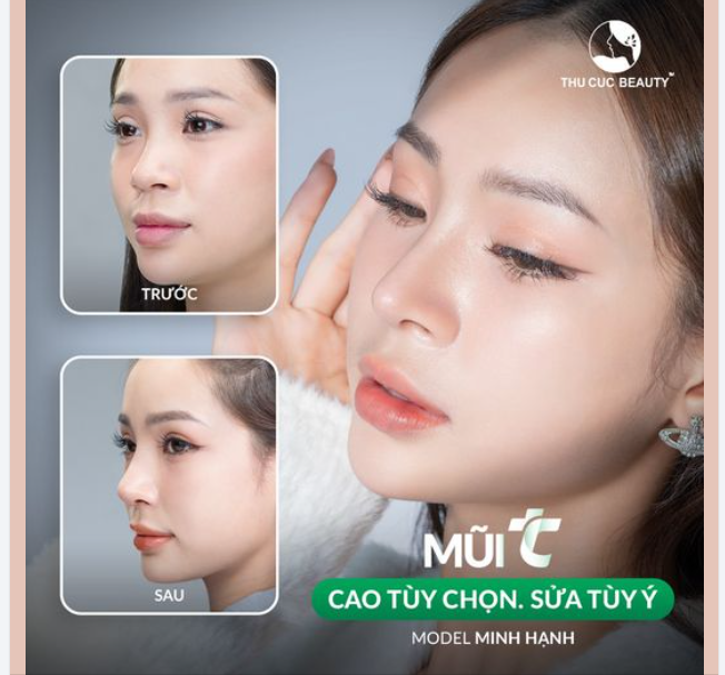 Phong ấn nhan sắc với chiếc mũi tẹt 