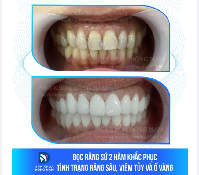 NỤ CƯỜI MỚI - KHỞI ĐẦU HÀNH TRÌNH YÊU THƯƠNG BẢN THÂN