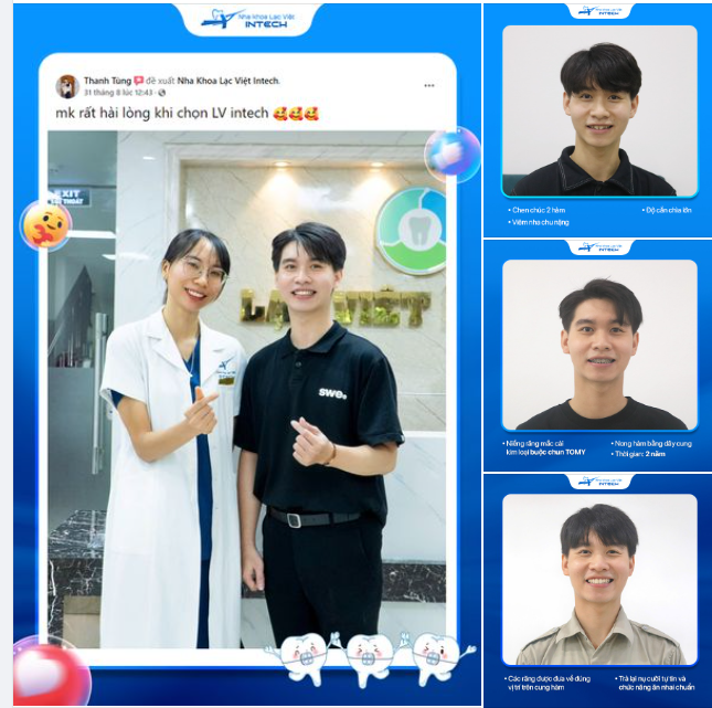 "QUYẾT ĐỊNH ĐÚNG ĐẮN NHẤT LÀ ĐÃ NIỀNG RĂNG TẠI NHA KHOA LẠC VIỆT INTECH"