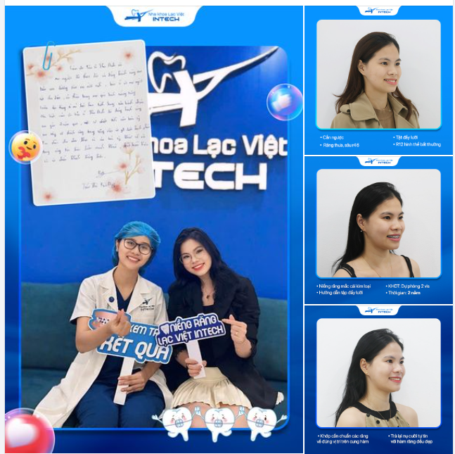 "THÁO NIỀNG XINH ĐẸP HƠN TẠI SAO KHÔNG NIỀNG RĂNG SỚM HƠN NHỈ?"