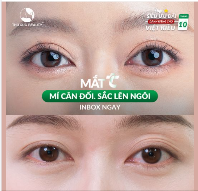 Đôi mắt đẹp sau 15 phút khiến bạn trẻ đẹp rạng ngời
