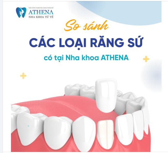 So sánh hai loại răng sứ hiện nay