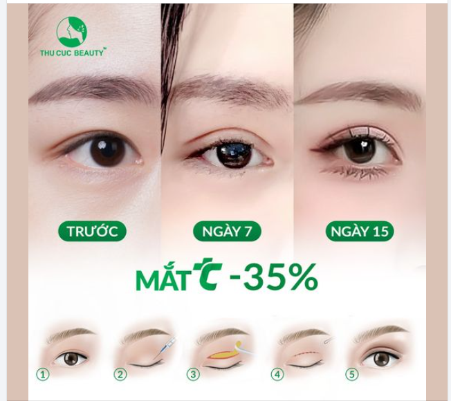 Mắt đẹp thế này đã đủ tự tin chưa bạn