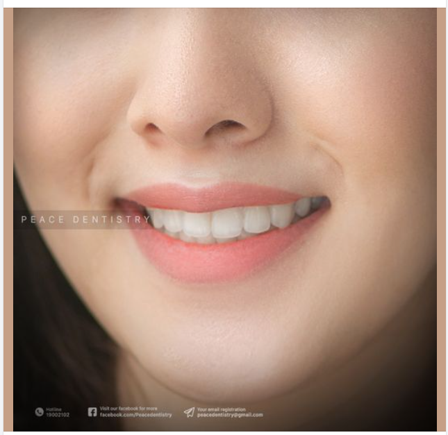 THẨM MỸ RĂNG SỨ TẠI PEACE DENTISTRY VÀ 2 NGUYÊN TẮC ĐIỀU TRỊ MẶC ĐỊNH