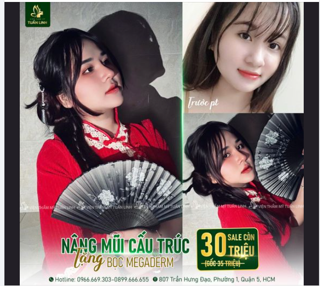Nâng mũi cấu trúc chỉ còn 30TR tặng ngay bọc Megaderm - Phương pháp nâng mũi hoàn hảo dành cho những bạn mũi nhiều khuyết điểm, lên dáng mũi mới theo mong muốn đây ạ!