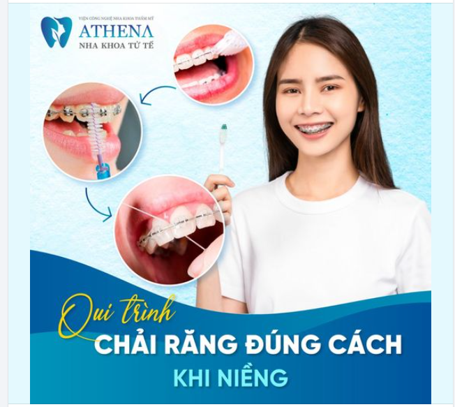 Quy trình chải răng đúng cách khi niềng
