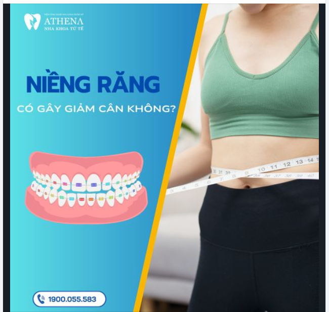 Có không ít người chia sẻ rằng sau khi niềng răng, họ đã giảm cân nhanh chóng. Nhưng liệu niềng răng thực sự giúp giảm cân, hay chỉ là một hiệu ứng nhất thời?